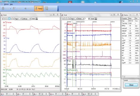 PULMODYN Data Acquisition Software for Respiratory Experiments